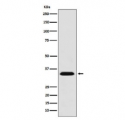 Western blot testing of human 293T cell lysate with MBD3 antibody. Predicted molecular weight ~33 kDa.