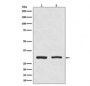 Western blot testing of human 1) HeLa and 2) Raji cell lysate with Bcl10 antibody. Expected molecular weight: 26-33 kDa.