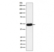 Western blot testing of human lung adenocarcinoma lysate with Napsin A antibody. Expected molecular weight: 38-45 kDa depending on glycosylation level.