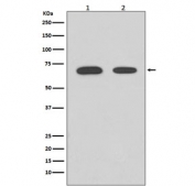 Western blot testing of human 1) HeLa and 2) 239T cell lysate with CHEK2 antibody. Predicted molecular weight ~61 kDa.