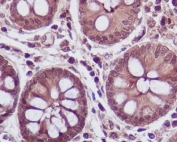 IHC staining of FFPE human colon tissue with LDHA antibody. HIER: boil tissue sections in pH6, 10mM citrate buffer, for 10-20 min and allow to cool before testing.