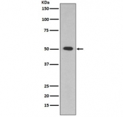 Western blot testing of human HepG2 cell lysate with ALDH1A1 antibody. Predicted molecular weight ~55 kDa.