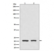 Western blot testing of 1) human HeLa cell lysate and 2) mouse spleen lysate with DHFR antibody. Expected molecular weight: 21-24 kDa.