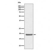 Western blot testing of human Jurkat cell lysate with SOD1 antibody. Predicted molecular weight ~16 kDa.