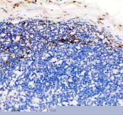 IHC staining of FFPE human appendix tissue with Factor XIIIa antibody, HRP-secondary and DAB substrate. HIER: boil tissue sections in pH8 EDTA for 20 min and allow to cool before testing.