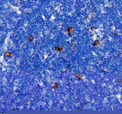 IHC staining of FFPE rat thymus tissue with Factor XIIIa antibody, HRP-secondary and DAB substrate. HIER: boil tissue sections in pH8 EDTA for 20 min and allow to cool before testing.