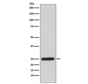 Western blot testing of human A549 cell lysate with HPRT antibody. Predicted molecular weight ~24 kDa.