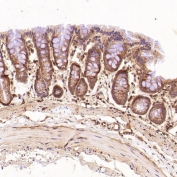 IHC staining of FFPE rat stomach tissue with EGFR antibody. HIER: boil tissue sections in pH6, 10mM citrate buffer, for 10-20 min and allow to cool before testing.