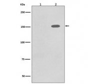 Western blot testing of lysate from human A431 cells 1) untreated and 2) treated with EGF, with phospho-EGF Receptor antibody. Expected molecular weight: 134-170 kDa depending on glycosylation level.