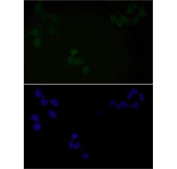 Immunofluorescent staining of FFPE human HeLa cells with Phospho-EGF Receptor antibody (green) and DAPI nuclear stain (blue). HIER: steam section in pH6 citrate buffer for 20 min.