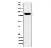 Western blot testing with Prothrombin antibody. Predicted molecular weight ~70 kDa but may be observed at higher molecular weights due to glycosylation.