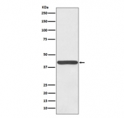 Western blot testing of human plasma lysate with Haptoglobin antibody. Predicted molecular weight: 45-50 kDa (alpha + beta chain).