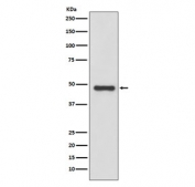 Western blot testing of human LNCaP cell lysate with uPA antibody. Predicted molecular weight ~48 kDa.