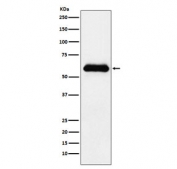 Western blot testing of human plasma lysate with SERPINA3 antibody. Expected molecular weight: 47-65 kDa, depending on level of glycosylation.