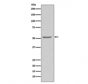 Western blot testing of human 293T cell lysate with Angiotensinogen antibody. Predicted molecular weight ~56 kDa.