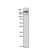 Western blot testing of human MCF7 cell lysate with C3 antibody. Expected molecular weight: ~185 kDa (alpha + beta chain), ~110 kDa (alpha chain).