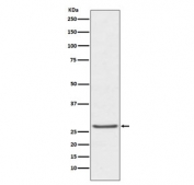 Western blot testing of human prostate cancer lysate with TIMP1 antibody. Expected molecular weight: 23-28 kDa depending on the level of glycosylation.
