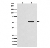 Western blot testing of lysate from 1) untreated and 2) Calyculin A and Okadaic Acid-treated human HeLa cells with phospho-c-Myc antibody. Theoretical molecular weight: ~50 kDa but routinely observed at 50~70 kDa.