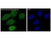 IF/ICC staining of human HeLa cells with KRAS/HRAS/NRAS antibody (green) and DAPI nuclear stain (blue).