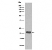 Western blot testing of human MCF7 cell lysate with HRAS antibody. Predicted molecular weight ~21 kDa.
