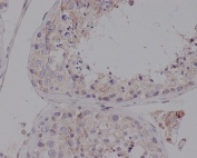 IHC staining of FFPE human testis tissue with LDLR antibody. HIER: boil tissue sections in pH6, 10mM citrate buffer, for 10-20 min and allow to cool before testing.
