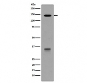 Western blot testing of human HepG2 cell lysate with LDLR antibody. Expected molecular weight: 95-160 kDa depending on glycosylation level.