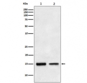 Western blot testing of human 1) HepG2 and 2) fetal liver lysate with TGFA antibody. Predicted molecular weight ~17 kDa.