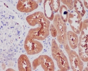 IHC staining of FFPE human kidney tissue with NGF antibody. HIER: boil tissue sections in pH6, 10mM citrate buffer, for 10-20 min and allow to cool before testing.