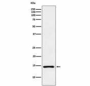 Western blot testing of human PC-3 cell lysate with Atrial Natriuretic Peptide antibody. Predicted molecular weight ~17 kDa.
