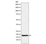 Western blot testing of human pituitary lysate with TSH beta antibody. Predicted molecular weight ~16 kDa.