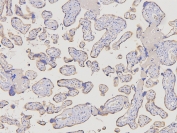 IHC staining of FFPE human placental tissue with D6 antibody at 1ug/ml. HIER: boil tissue sections in pH6, 10mM citrate buffer, for 10-20 min and allow to cool before testing.