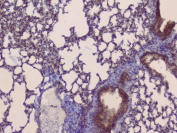 IHC staining of FFPE mouse lung with SLC34A2 antibody. HIER: boil tissue sections in pH6, 10mM citrate buffer, for 10-20 min and allow to cool before testing.