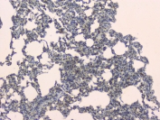 IHC staining of FFPE rat lung with SLC34A2 antibody. HIER: boil tissue sections in pH6, 10mM citrate buffer, for 10-20 min and allow to cool before testing.
