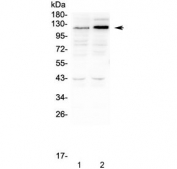 Western blot testing of human 1) HEK293 and 2) K562 cell lysate with SLC34A2 antibody at 0.5ug/ml. Predicted molecular weight ~76 kDa, but may be observed at up to ~130 kDa due to glycosylation.