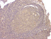 IHC staining of FFPE human tonil with BMP15 antibody at 1ug/ml. HIER: boil tissue sections in pH6, 10mM citrate buffer, for 10-20 min and allow to cool before testing.