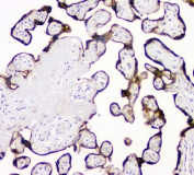 IHC staining of FFPE human placental tissue with tPA antibody at 1ug/ml. HIER: boil tissue sections in pH6, 10mM citrate buffer, for 10-20 min and allow to cool before testing.