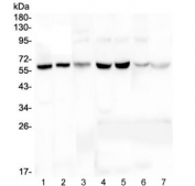 Western blot testing of 1) human HeLa, 2) human U-2 OS, 3) human U-87 MG, 4) rat liver, 5) rat kidney, 6) mouse liver and 7) mouse kidney lysate with tPA antibody at 0.5ug/ml. Expected molecular weight: 64-70 kDa.