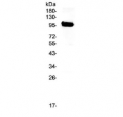 Western blot testing of human T-47D cell lysate with APP antibody at 0.5ug/ml. Expected molecular weight 79~120 kDa depending on glycosylation level.