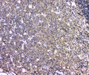 IHC staining of FFPE human tonsil with L Plastin antibody at 1ug/ml. HIER: boil tissue sections in pH6, 10mM citrate buffer, for 10-20 min and allow to cool before testing.