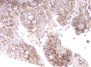 IHC staining of FFPE human tonsil with L Plastin antibody at 1ug/ml. HIER: boil tissue sections in pH6, 10mM citrate buffer, for 10-20 min and allow to cool before testing.