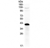 Western blot testing of human placenta lysate with HSD17B1 antibody at 0.5ug/ml. Predicted molecular weight ~35 kDa.