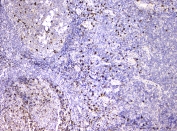 IHC staining of FFPE human tonsil tissue with IGLL1 antibody at 1ug/ml. HIER: boil tissue sections in pH6, 10mM citrate buffer, for 10-20 min and allow to cool before testing.