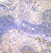 IHC staining of FFPE mouse spleen with IGLL1 antibody at 1ug/ml. HIER: boil tissue sections in pH6, 10mM citrate buffer, for 10-20 min and allow to cool before testing.