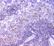 IHC staining of FFPE rat spleen with IGLL1 antibody at 1ug/ml. HIER: boil tissue sections in pH6, 10mM citrate buffer, for 10-20 min and allow to cool before testing.