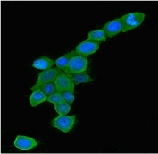 Immunofluorescent staining of FFPE human MCF7 cells with RAB5A antibody (green) and DAPI nuclear stain (blue). HIER: steam section in pH6 citrate buffer for 20 min.