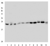 Western blot testing of human 1) HeLa, 2) placenta, 3) A549, 4) A375, 5) SW620, 6) U-2 OS, 7) HEK293, 8) U-87 MG, 9) rat brain, 10) mouse brain and 11) mouse Neuro-2a lysate with RAB5A antibody. Predicted molecular weight ~25 kDa.