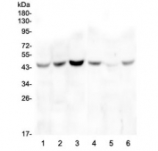 Western blot testing of human 1) HeLa, 2) placenta, 3) A549, 4) T-47D, 5) PC-3 and 6) U-2 OS cell lysate with ZP3 antibody at 0.5ug/ml. Predicted molecular weight ~47 kDa.