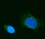 Immunofluorescent staining of FFPE human SiHa cells with CHM antibody (green) and DAPI nuclear stain (blue). HIER: steam section in pH6 citrate buffer for 20 min.