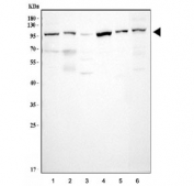 Western blot testing of human 1) HeLa, 2) placenta, 3) 293T, 4) A431, 5) Caco-2 and 6) SiHa cell lysate with CHM antibody. Predicted molecular weight ~73 kDa.