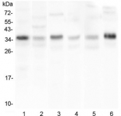 Western blot testing of 1) human HL-60, 2) human U-87 MG, 3) rat liver, 4) rat stomach, 5) mouse spleen and 6) mouse thymus lysate with CD40L antibody at 0.5ug/ml. Expected molecular weight: 29-39 kDa (depending on glycosylation level) or ~18 kDa (soluble form).